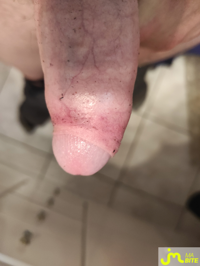 bites de hestd