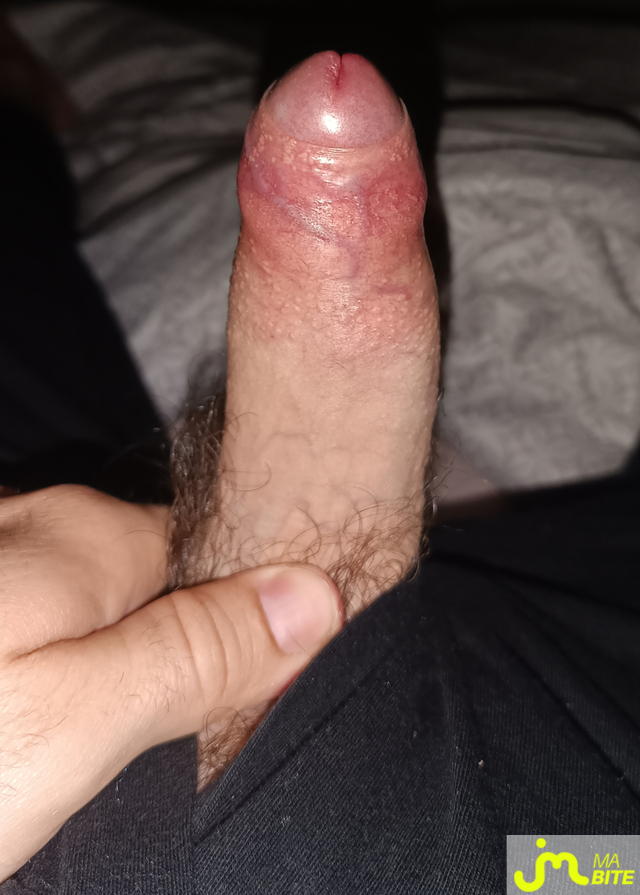 bites de Marty62300