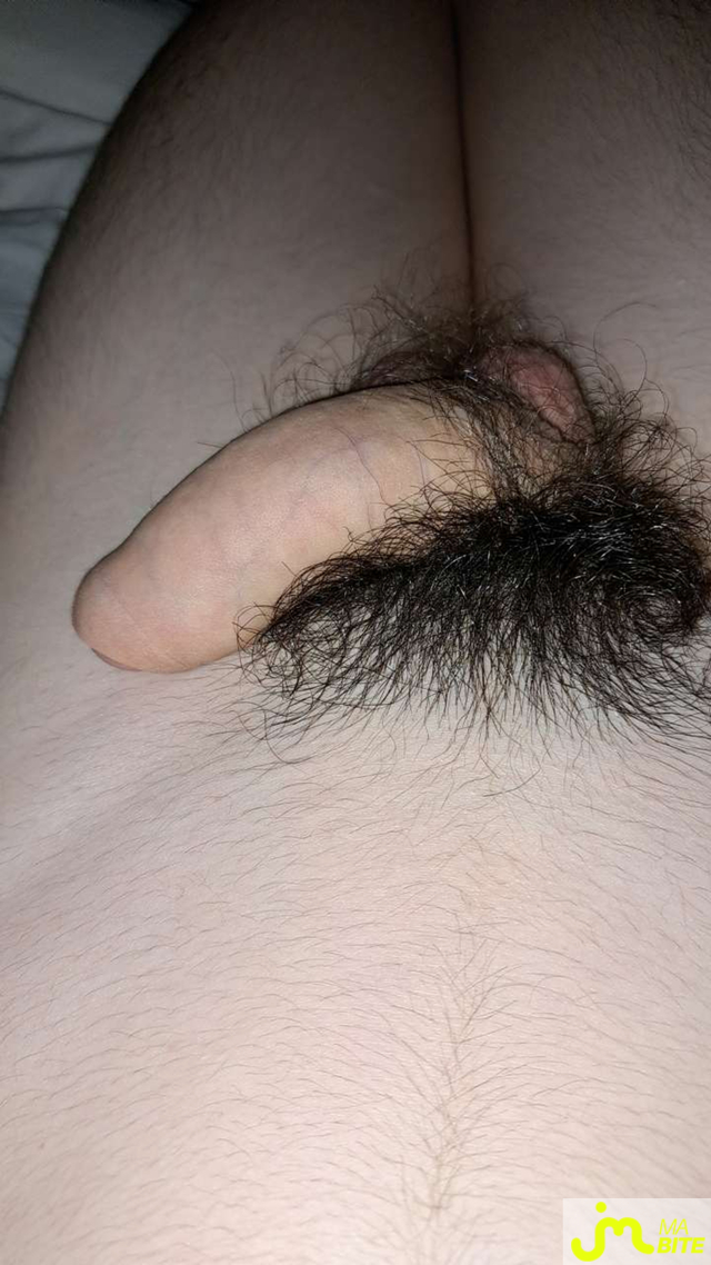 bites de Akonime
