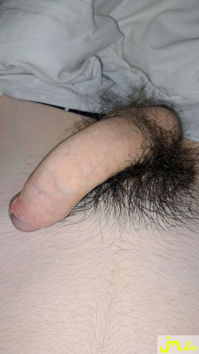 bites de Akonime