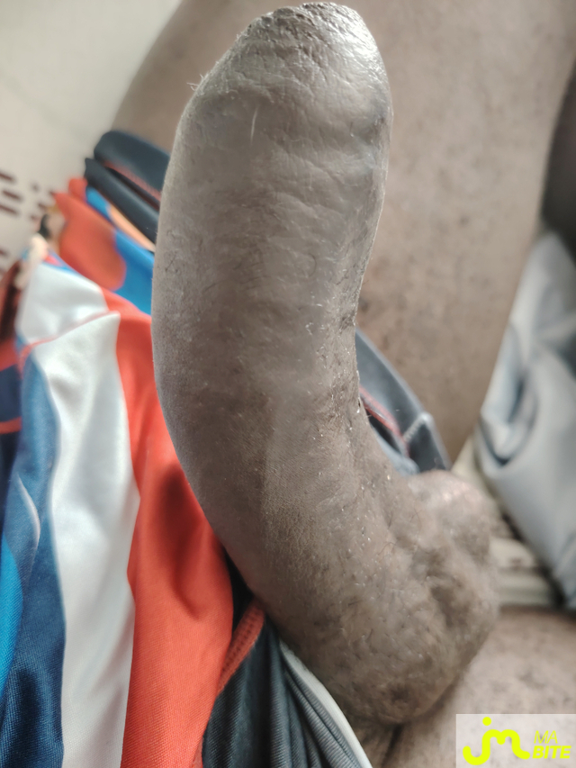 bites de DickBlack