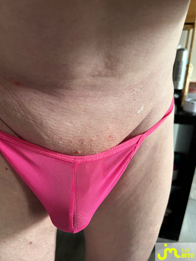 bites de Dhoudh41