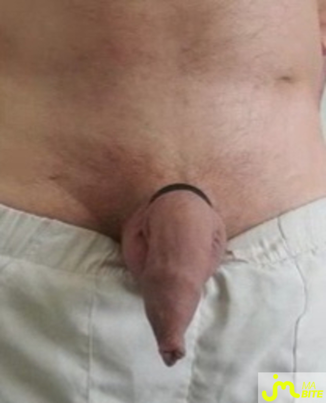 bites de Queute19
