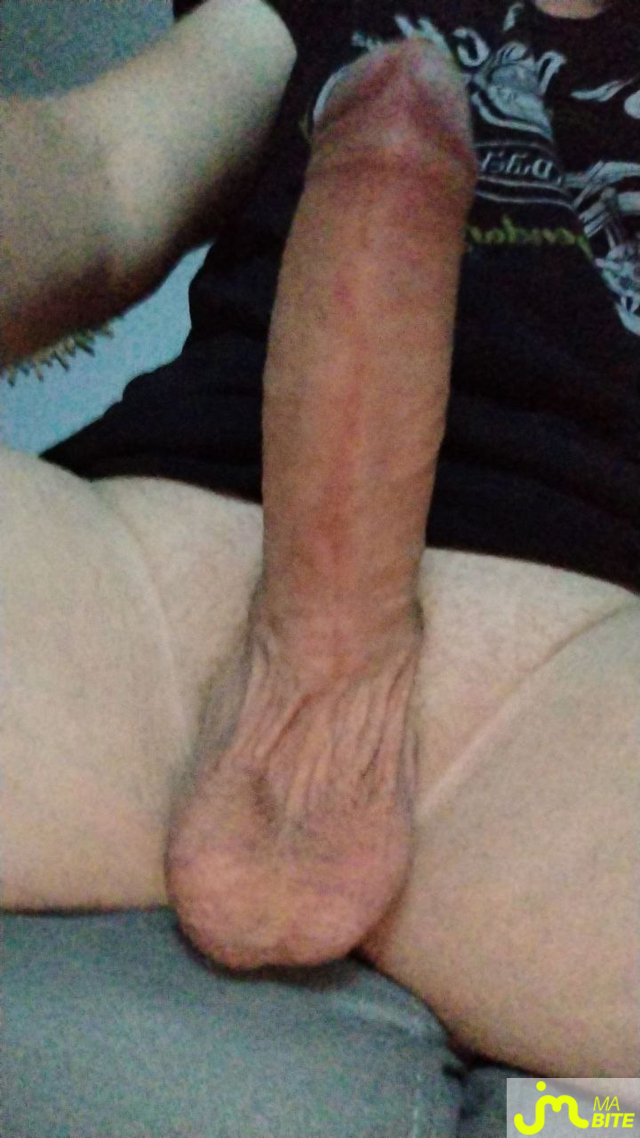bites de Motardchaud