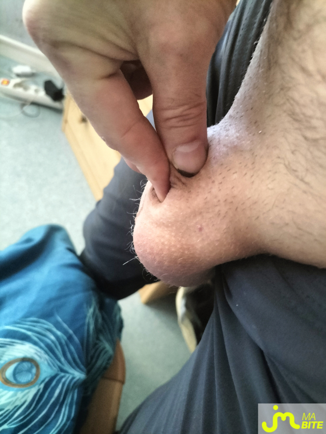 bites de Titi43