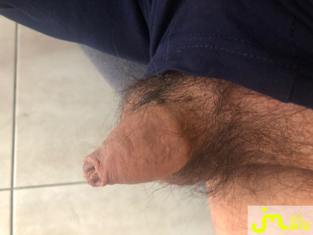 bites de Gerfaut