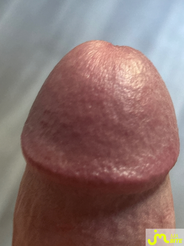 bites de Ziodinamite