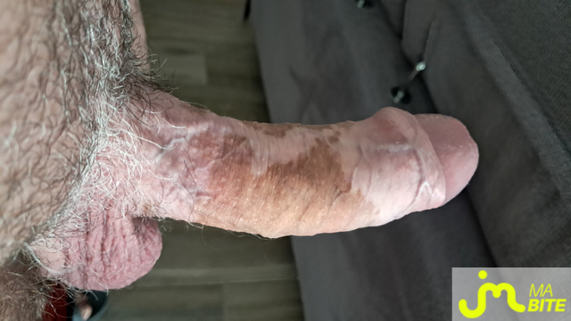 bites de desors59