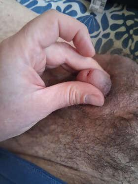 Photos de bites : micro penis