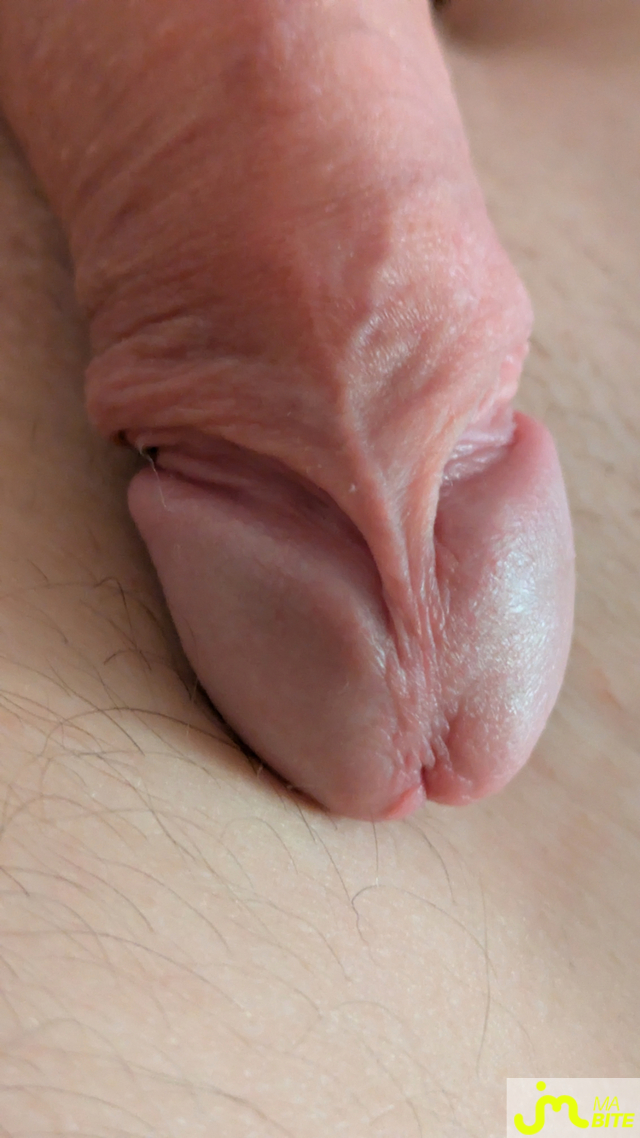 bites de jey
