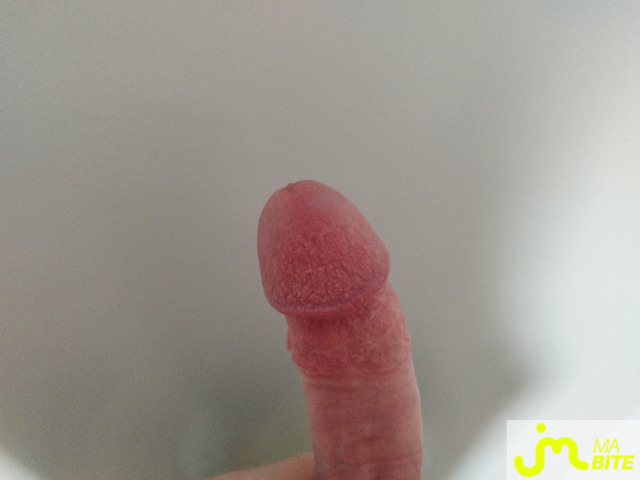 bites de Moro11