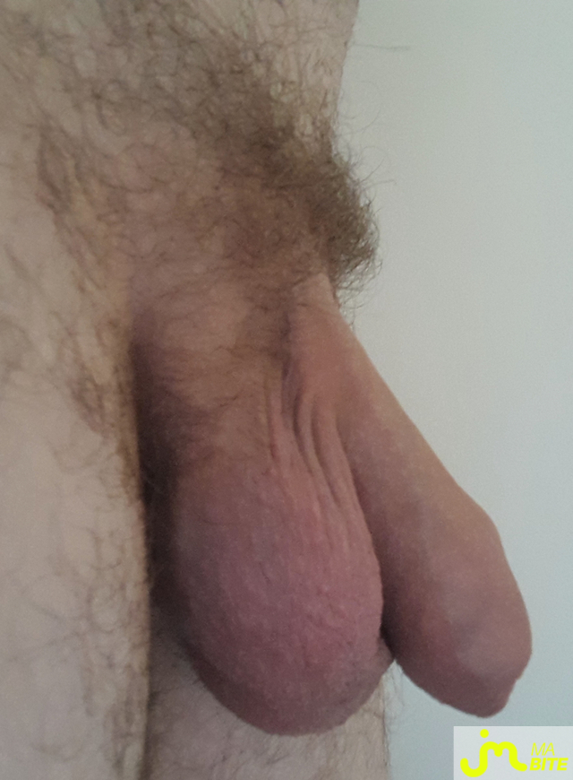 bites de Mct