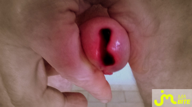 bites de Vxmâlebi46