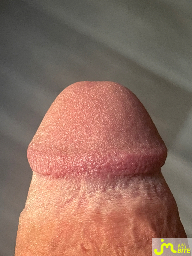 bites de Ziodinamite