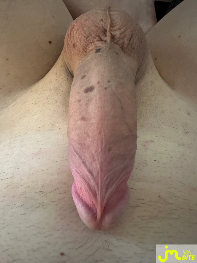 bites de Joli17