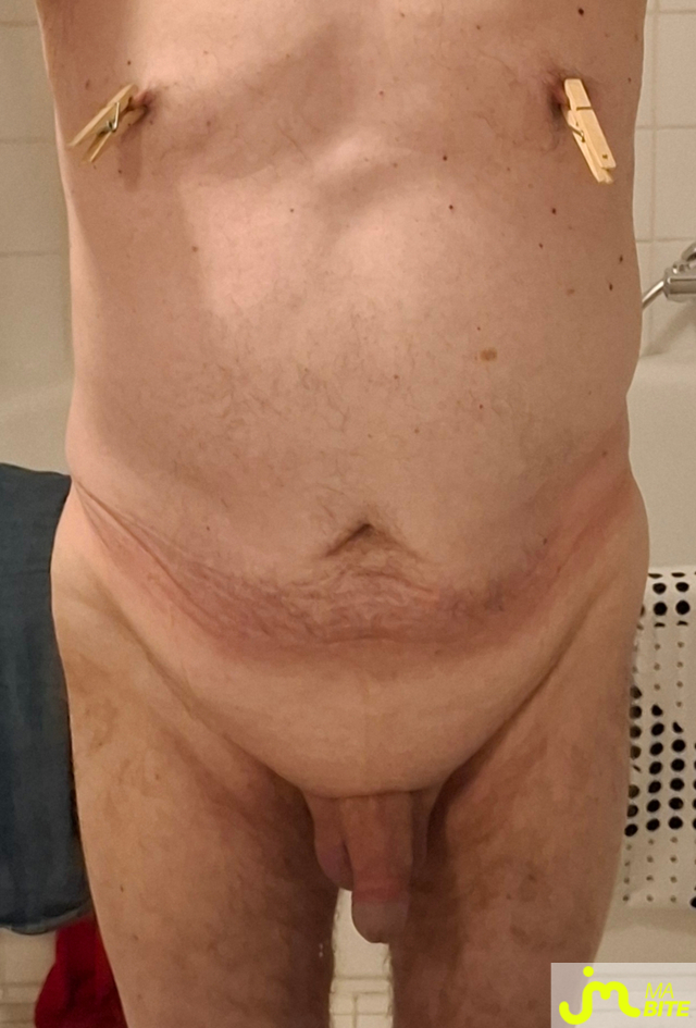 bites de basenhau