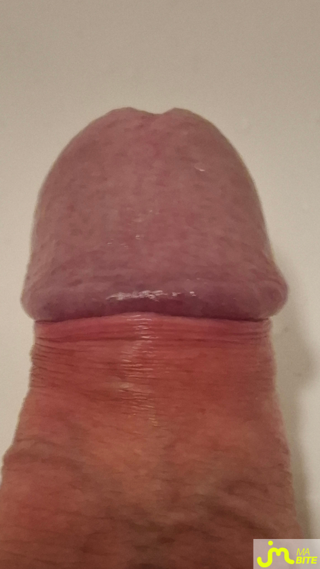 bites de basenhau