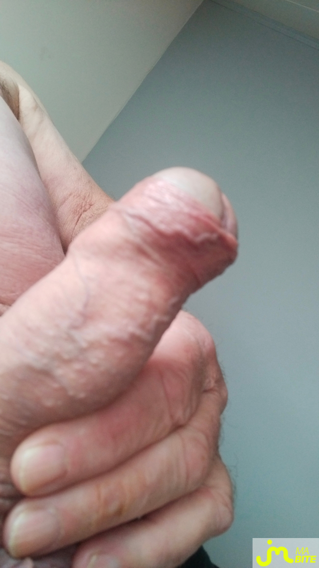 bites de Albatros64 