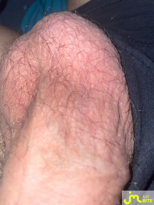 bites de Xonox48