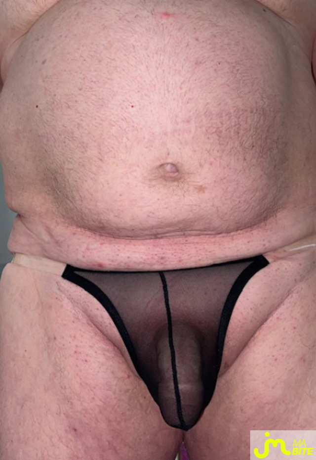 bites de EnSLIP