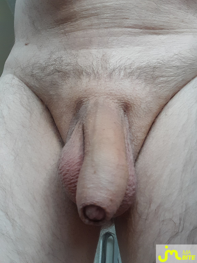 bites de Ramgoolam