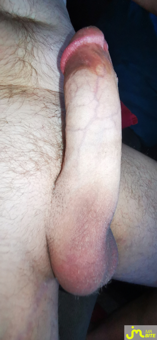 bites de Petivié