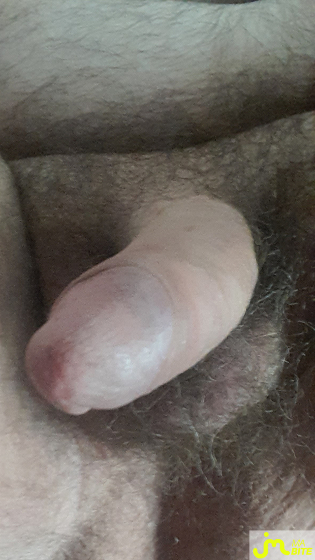 bites de freeman9225