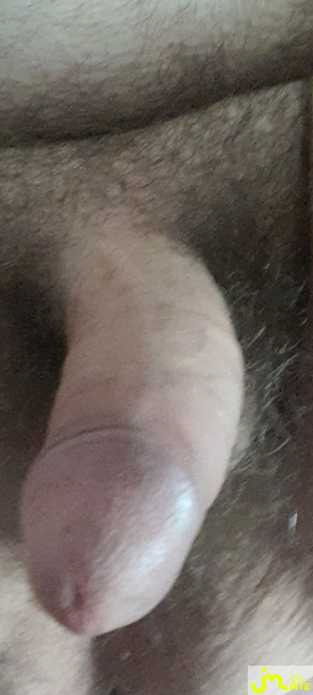 bites de freeman9225