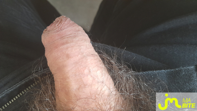 bites de freeman9225