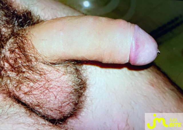 bites de surprisedu47