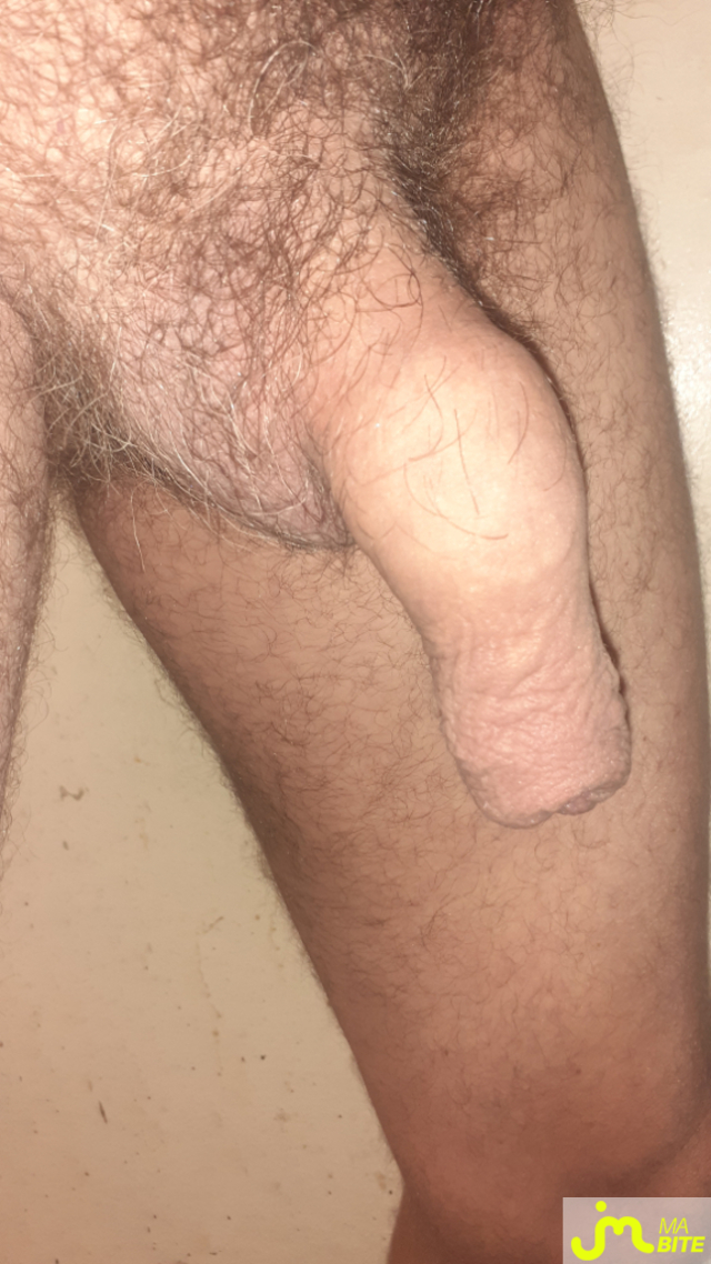 bites de Des mains