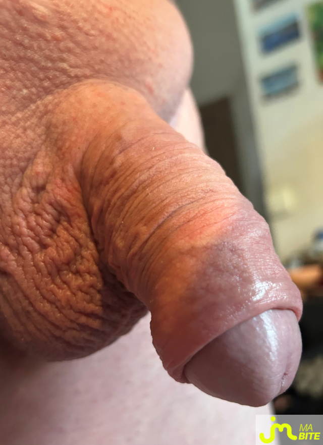 bites de Dhoudh41
