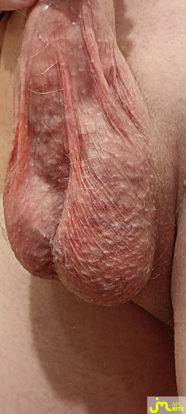 bites de Célestyn