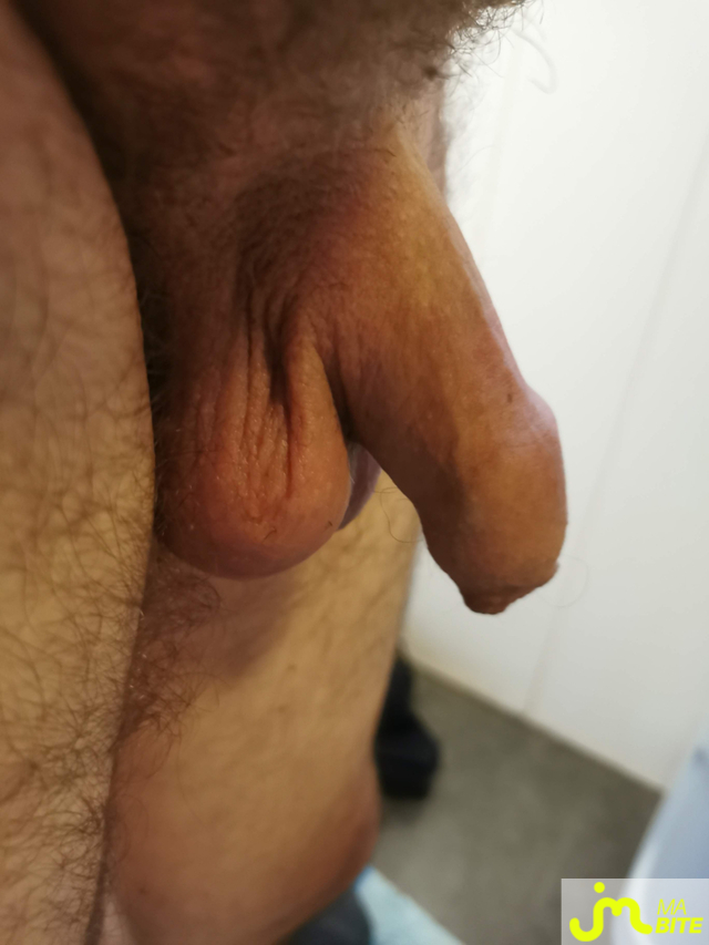 bites de Petrus02