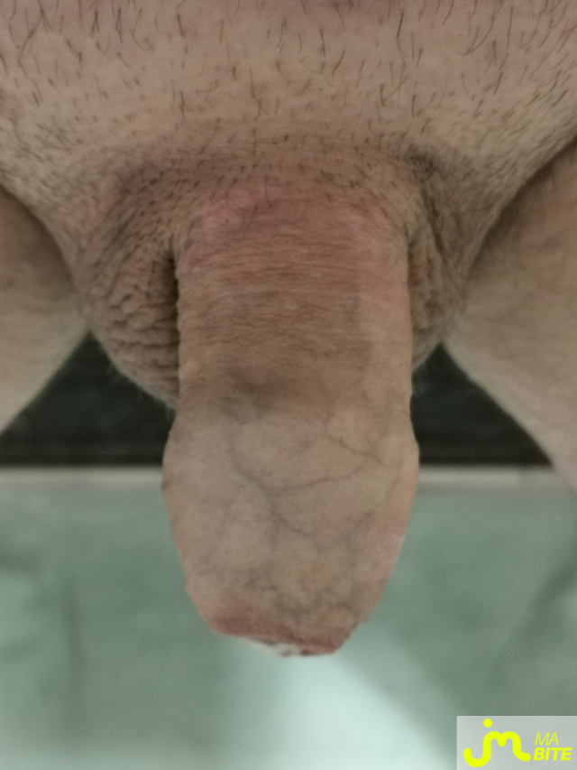 bites de Mric760