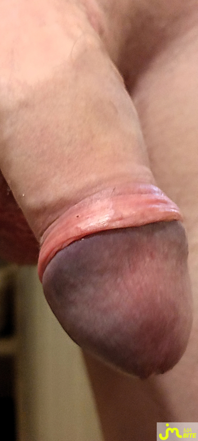 bites de Célestyn