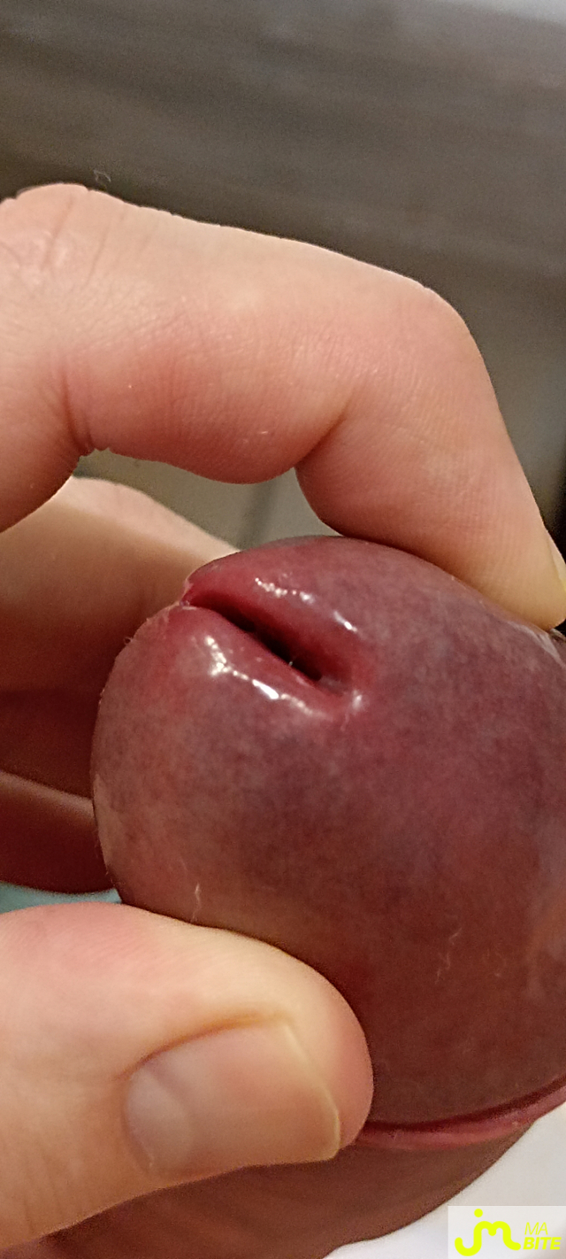 bites de Célestyn