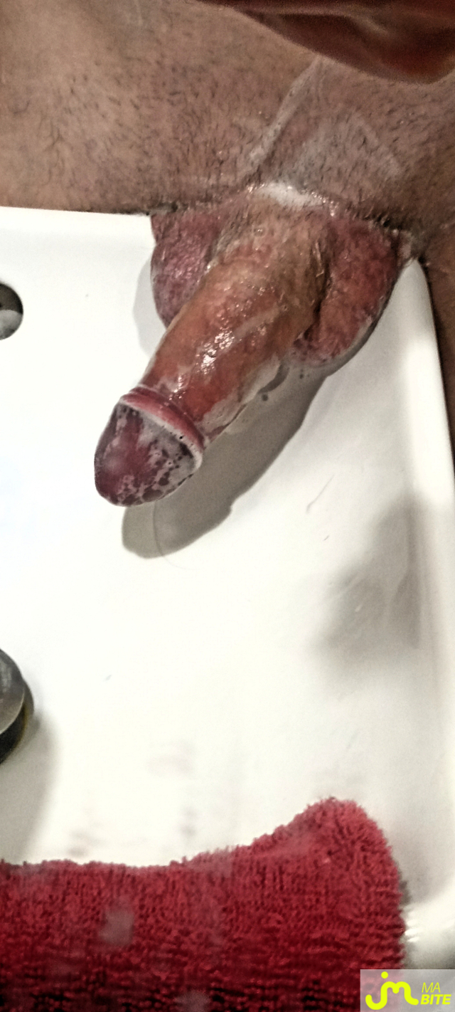 bites de Célestyn