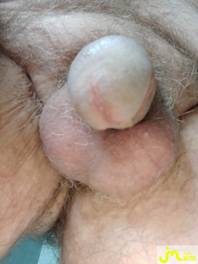 bites de Yug44 