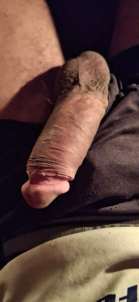Photos de bites : Contribution 1