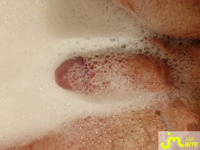 bites de Gland d'or 