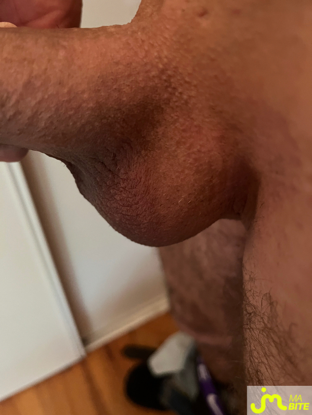 bites de Fanfans