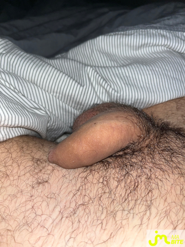 bites de Booboo01