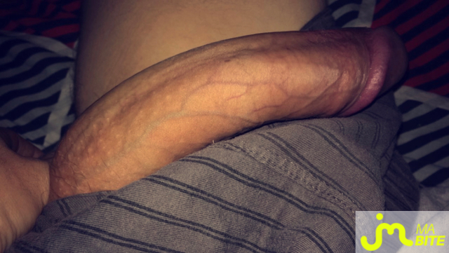 bites de Anonymous19