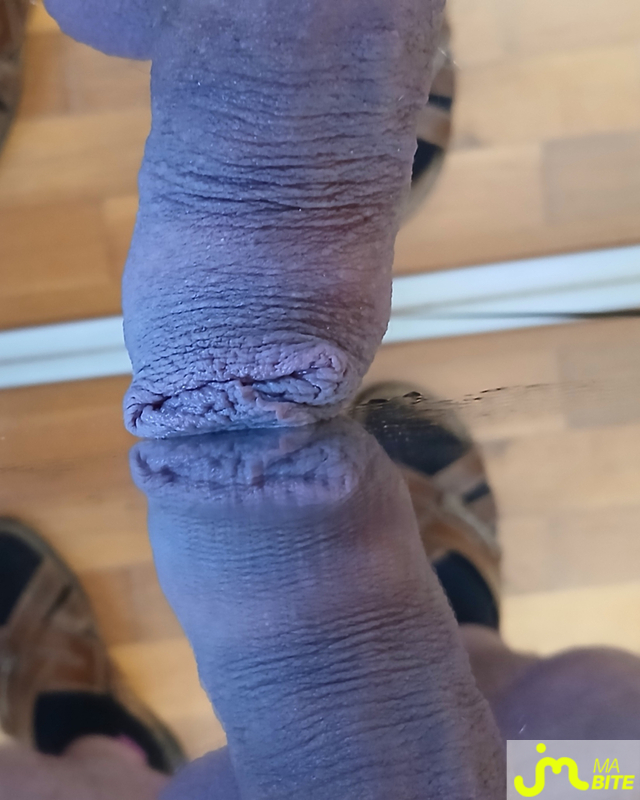 bites de 84mx