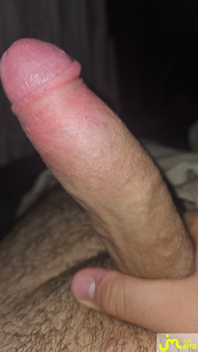 bites de Reter