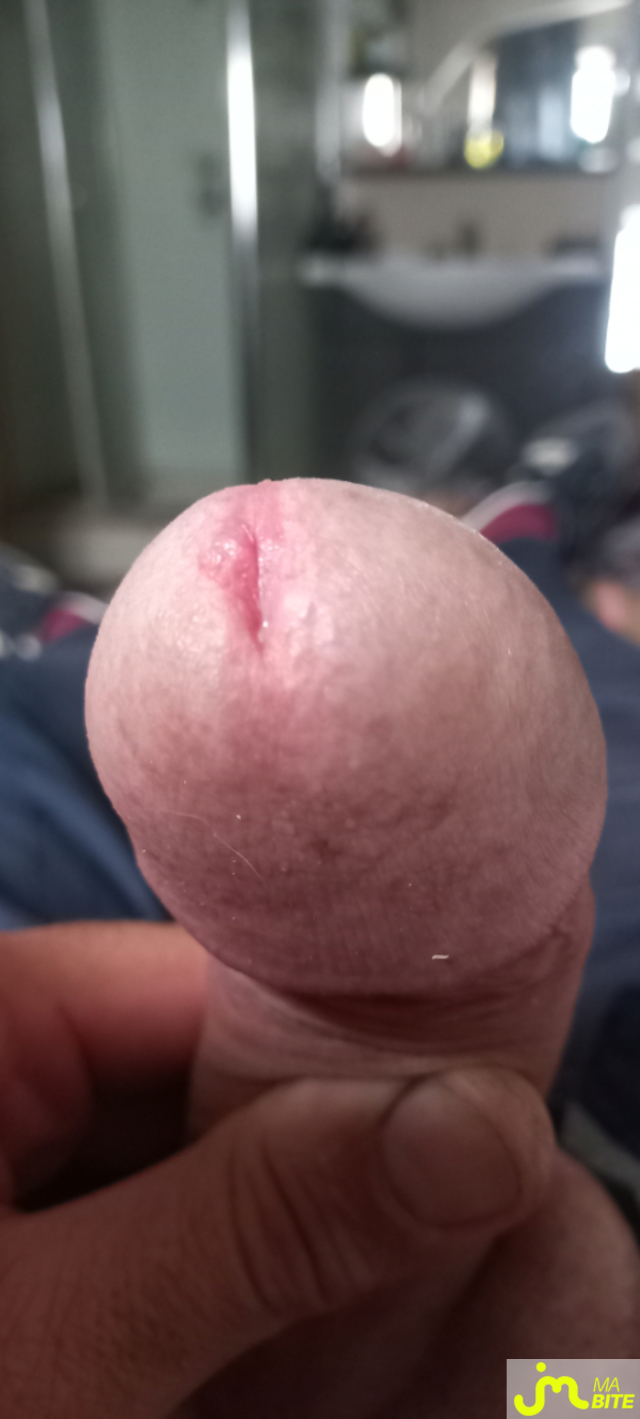 bites de Ben62split