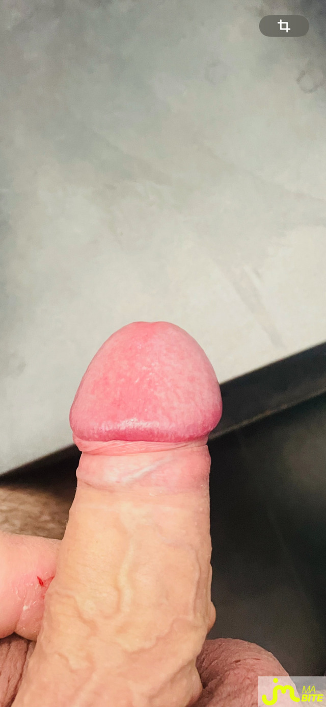bites de Lanchebre