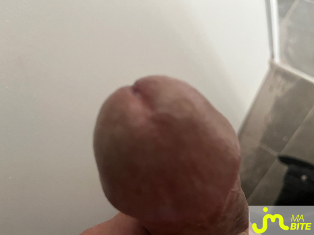 bites de Raou