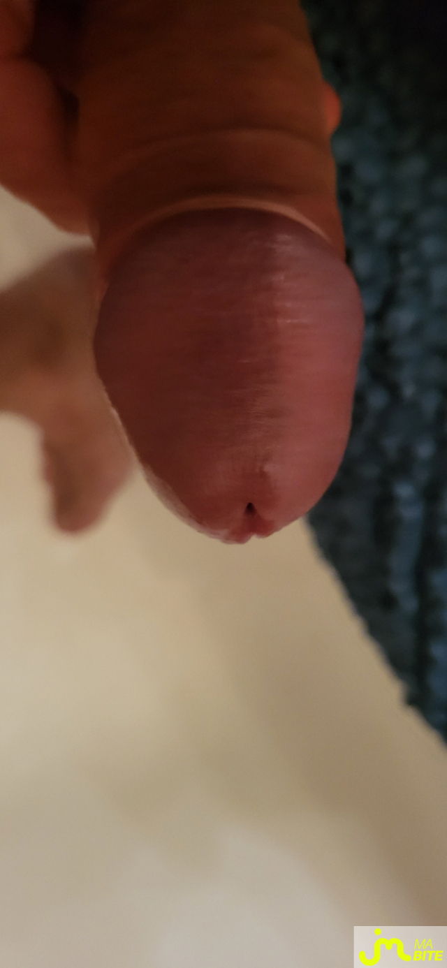 bites de Govizy